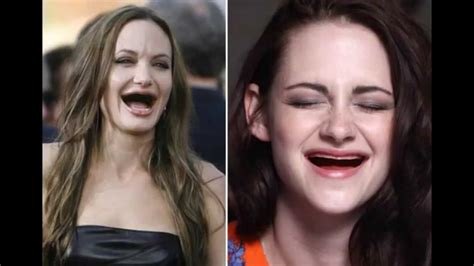 Celebrities Without Teeth Youtube