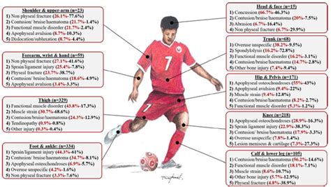 Quais as principais lesões no Futebol Ciência da Bola