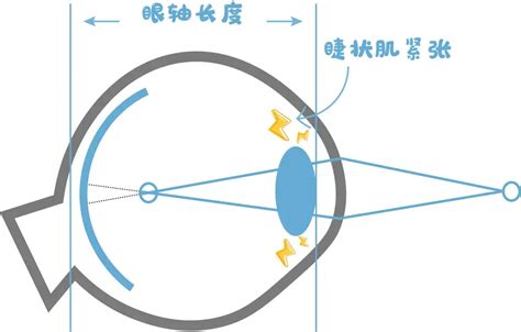 什么是散瞳（扩瞳）验光？散瞳对眼睛有危害吗？ 知乎