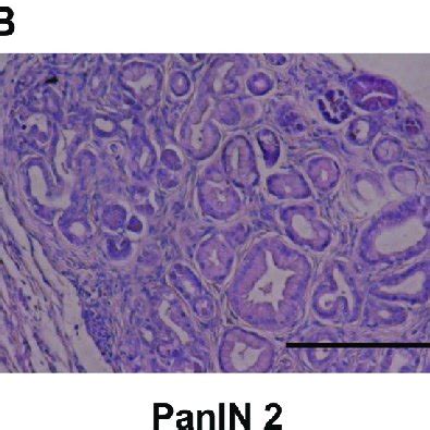 He Staining For Pancreatic Tissue A Normal Pancreatic Tissue In