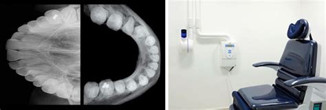 Radiografia Oclusal Barra Laudo