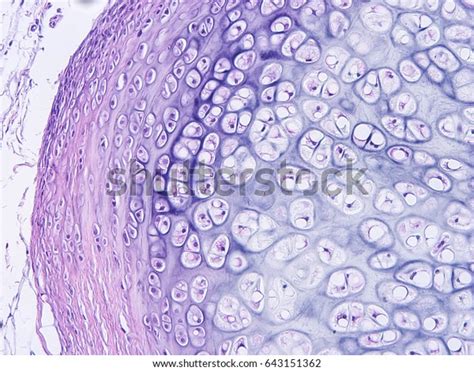 Histology Human Cartilage Connective Tissue Show Stock Photo (Edit Now) 643151362