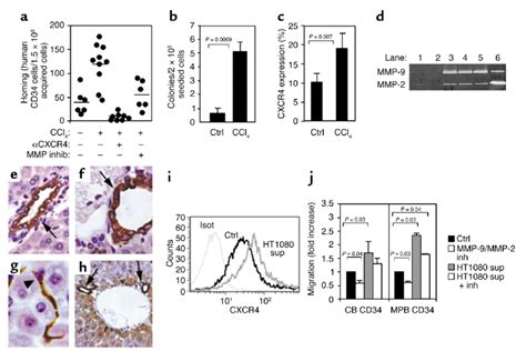 Stress Induced Mmp 2 And Mmp 9 Increase Progenitor Cell Motility And