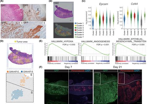 Spatial Topography Impacts Intratumoral Heterogeneity A H E Staining