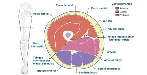 Amputación femoral Qué es causas síntomas tratamiento y consejos