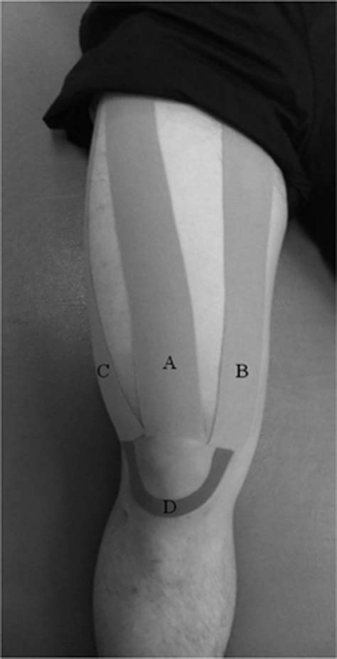 Effects Of Kinesiology Taping On Repositioning Error Of The Knee Joint