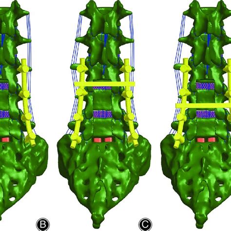 A Lateral View Of The Lumbosacral Spinal Model With The Multi Segment