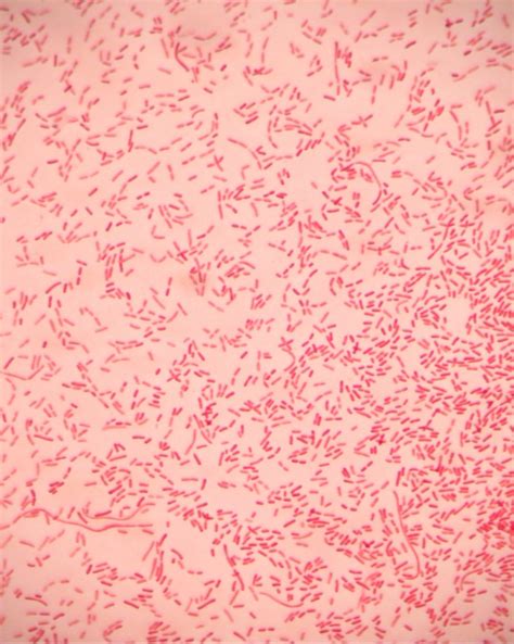 GRAM STAIN – Red Mountain Microbiology