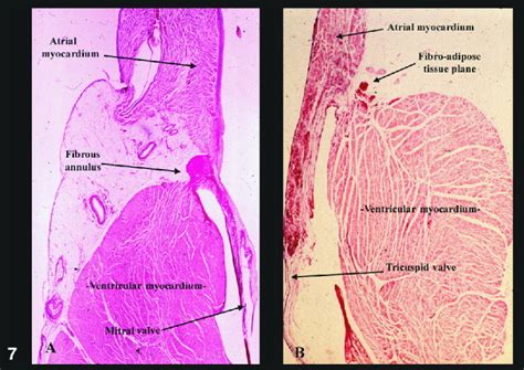 Interventricular Septum Histology