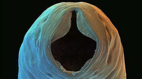 Slideshow: World's worst parasitic worms | Science | AAAS