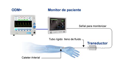 Monitorización De Presión Deltex Medical