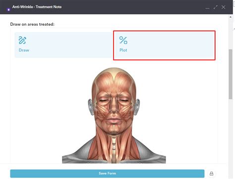 How To Mark Injection Points In A Treatment Note