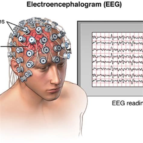 3 Electroencephalogram Download Scientific Diagram