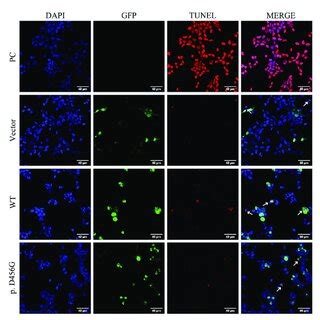 Tunel Assay Of Wild Type WT And P D456G AIFM1 Proteins In HEK293