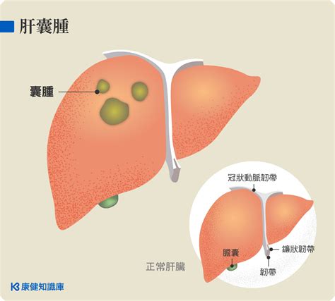 肝爹信箱有問必答35 秤子維的秘密花園 Udn部落格