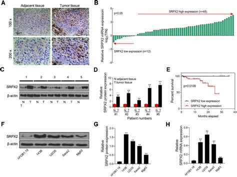 Expression Level Of Srpx2 Was Significantly Increased In Os Tissues And Download Scientific