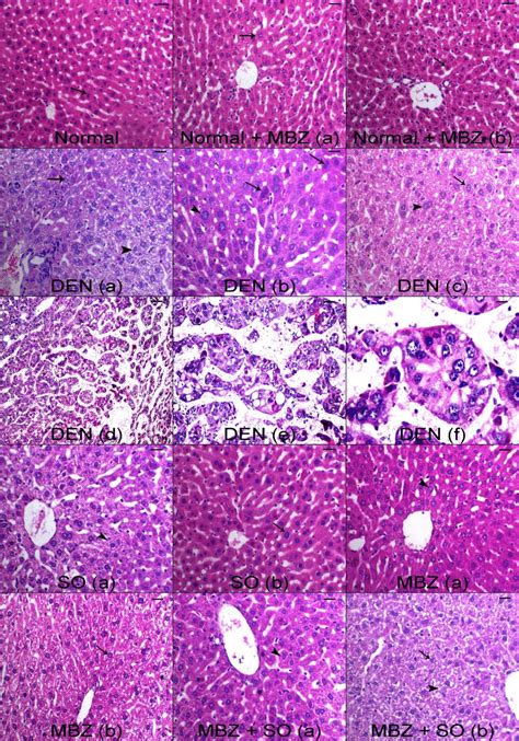 Representative light micrographs from (normal, normal + MBZ a ...