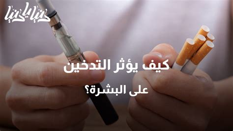 دنيا يا دنيا طب وصحة كيف يؤثر التدخين على البشرة؟ شاهد مجاناً