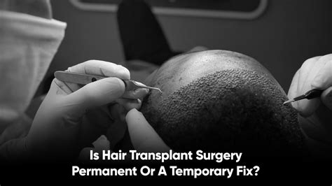 month  hair transplant qht regrow