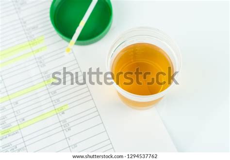 Check Routine Urinalysis Reagent Strip Urinalysis Stock Photo