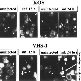 A Shutoff Of Host Protein Synthesis In Cells Infected With The Wt