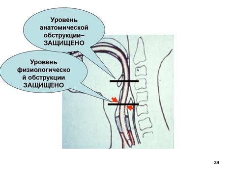 Анестезиология и реаниматология - презентация онлайн