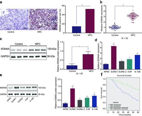 Kdm A Is Highly Expressed In Npc Clinical Samples And Cell Lines And