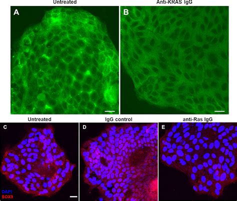 Frontiers Kras Specific Antibody Binds To Kras Protein Inside