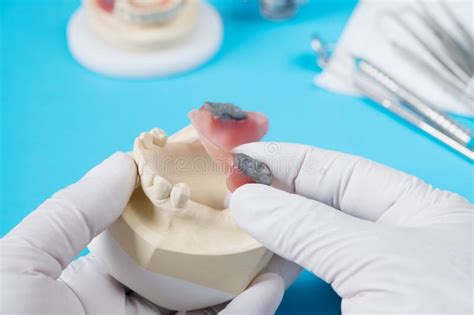 Herramientas Del Dentista Y Modelo Prosthodontic Imagen De Archivo