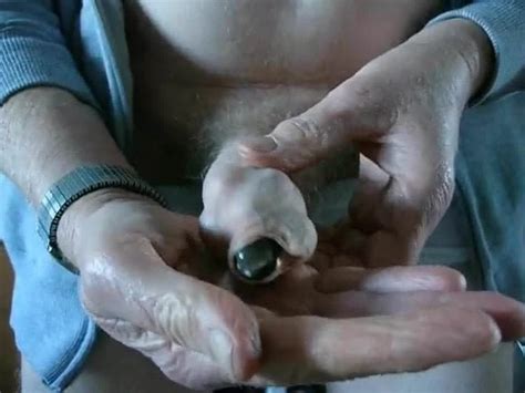 Foreskin Stuffed With Marbles Part Gay Man Porn Xhamster