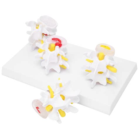 Buy Spine Model, Combination Spine Model Four-Stage Vertebrae