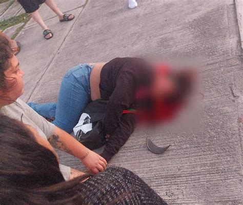 Pareja En Moto Resulta Con Graves Heridas Tras Ser Impactados En Los H Roes