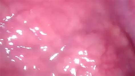 Endoscope Porn Videos Gay XXX 2024 XHamster