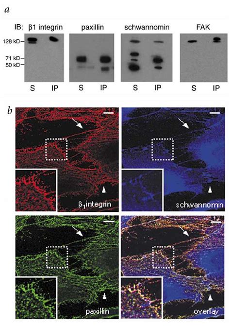 Schwannomin Coimunoprecipitates And Colocalizes With 1 Integrin Surface