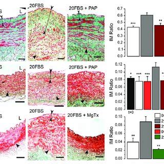 Kv1 3 Blockers Inhibited Fetal Bovine Serum FBS Induced Vascular