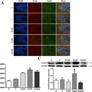 The Possible Effects And Underlying Mechanism Of Propofol On The Memory