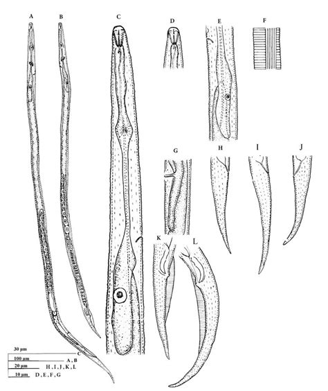 Ditylenchus Anchilisposomus A C J Female B K L Male A B Entire