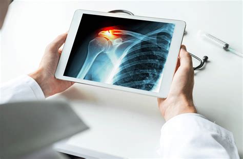 Shoulder Fracture Diagnosis and Treatment - Penn Medicine