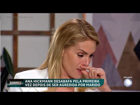 Exclusivo Ana Hickmann Desabafa Pela Primeira Vez Ap S Ser Agredida