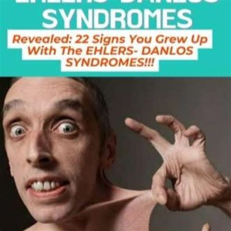 Stream Read Book ALL YOU NEED TO KNOW ABOUT THE EHLERS DANLOS SYNDROMES