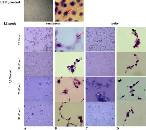 Photomicrograph Of Human Glioblastoma Cell Cultures Of The U Line