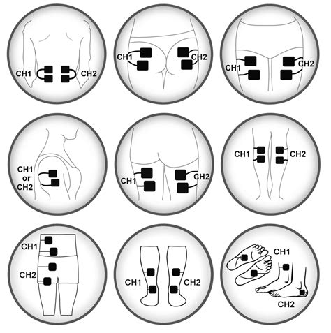 Tens Electrode Placement Chart