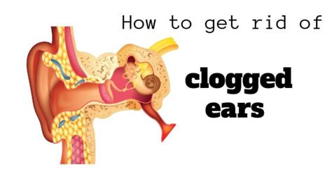 Clogged Ears