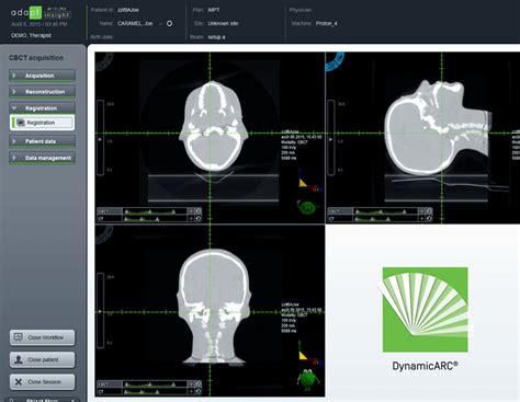 Discover More About Iba Proton Therapy