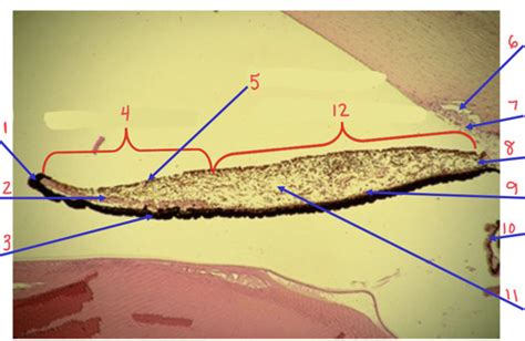 Iris and Ciliary body Lab quiz Flashcards | Quizlet
