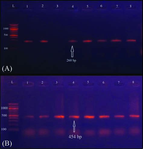 Ethidium Bromide Stained Agarose Gel Showing Monoplex Pcr For Detection