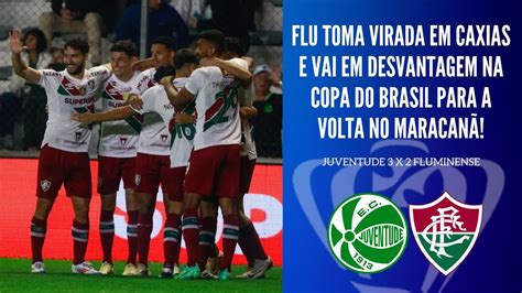 Fluminense Perde De Virada Para O Juventude E Ter Que Vencer Por