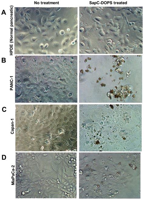 The Tumor Cells Panc Capan And Miapaca In B C And D