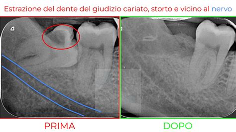 Chirurgia Orale Ambulatorio Pagnoni