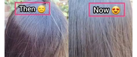 Tanpa Minyak Kemiri Ini Trik Menghitamkan Rambut Penuh Uban Di Usia